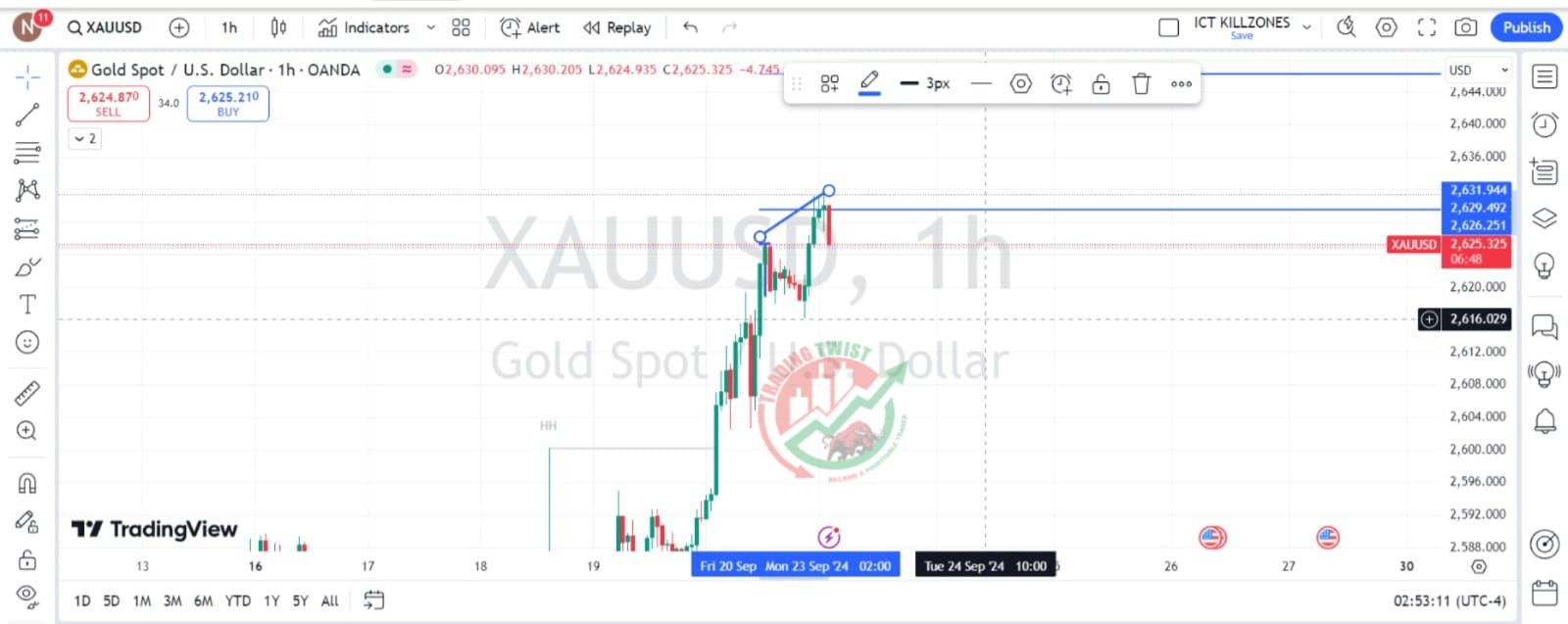 GOLD XAUUSD Chart Technical Outlook